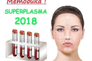 SUPERPLASMA 2018 - рекордна методика плазмотерапіі!